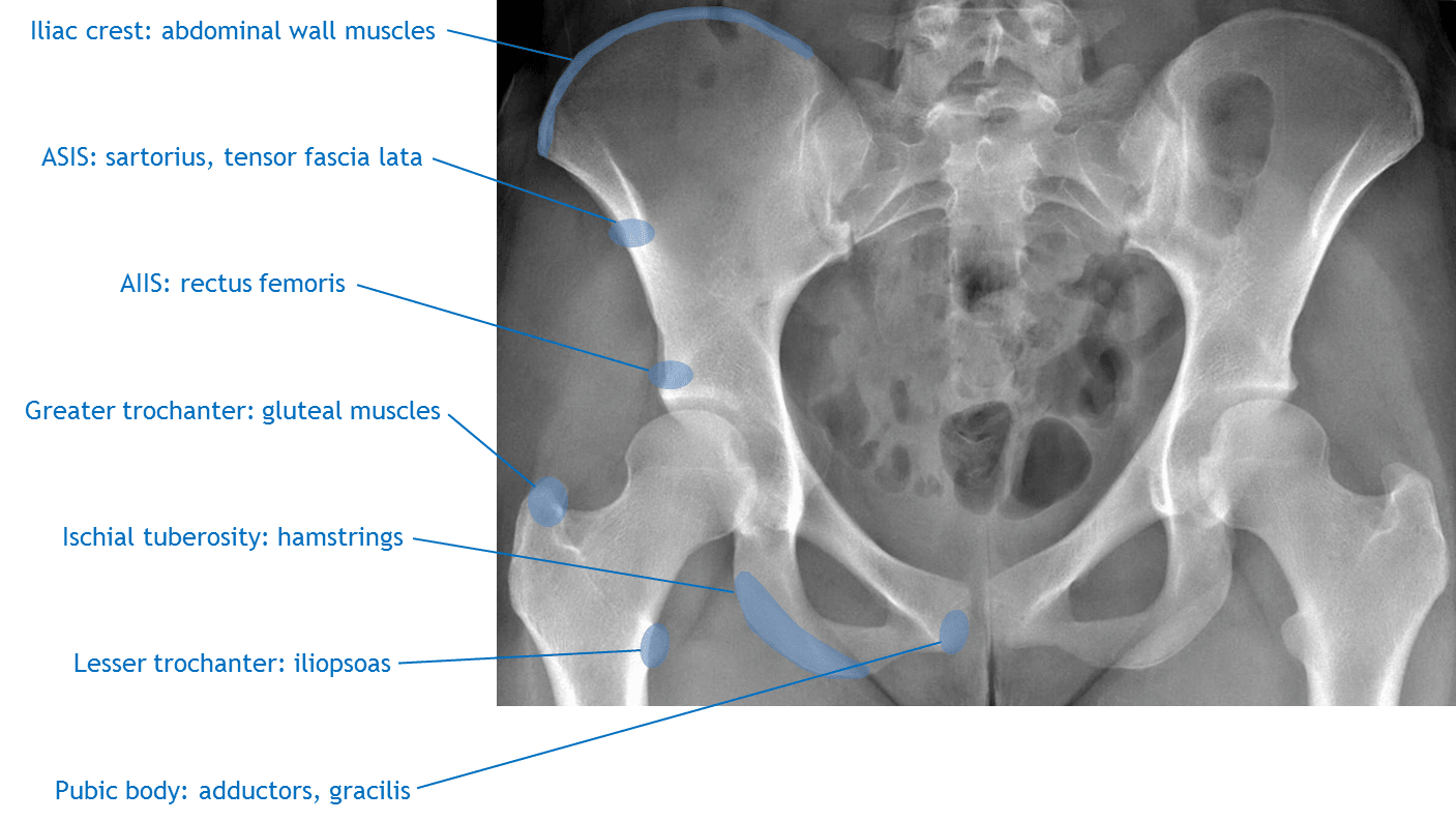 Sites of major muscle attachments on the anatomic pelvis.