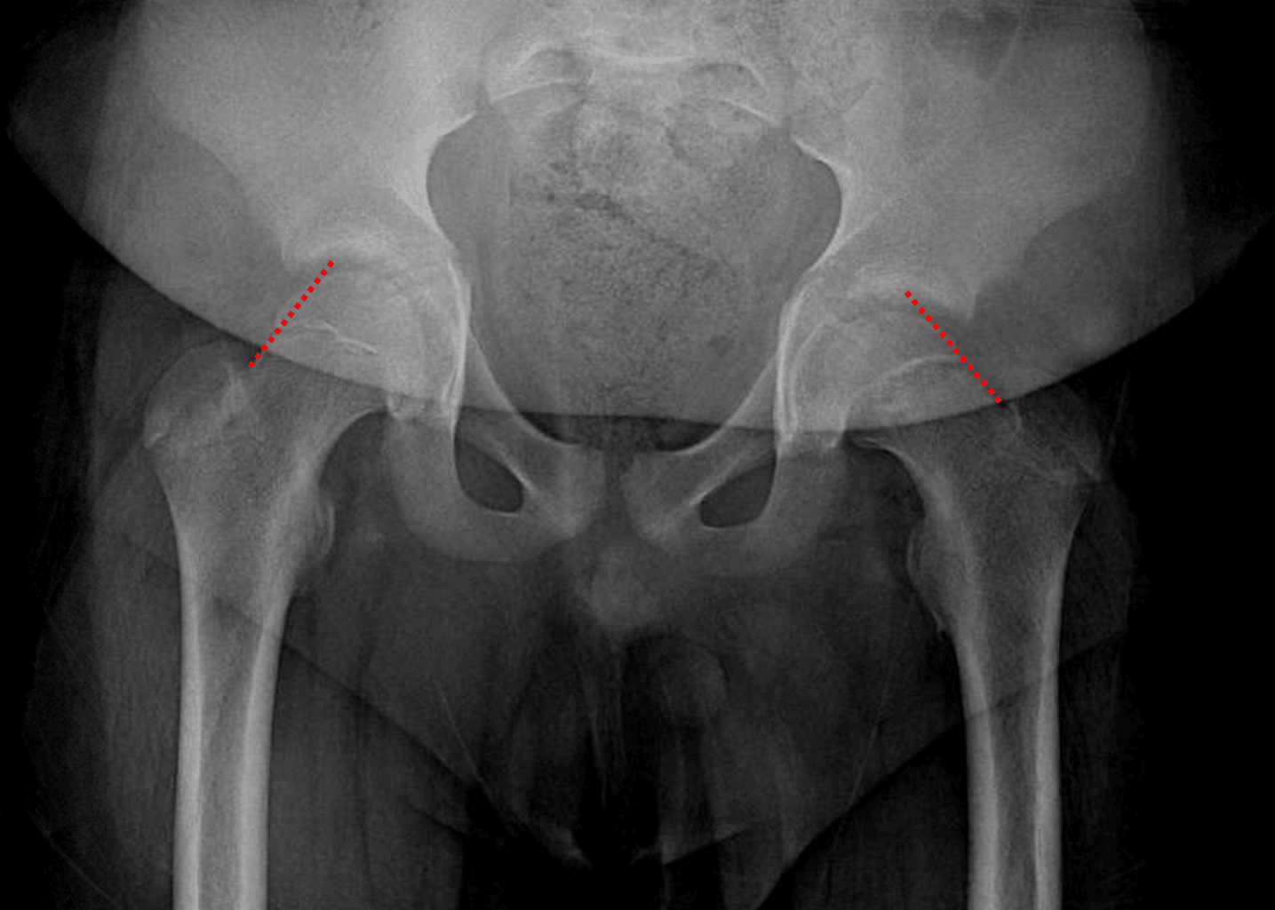 Radiology Case #1 | CaseStacks