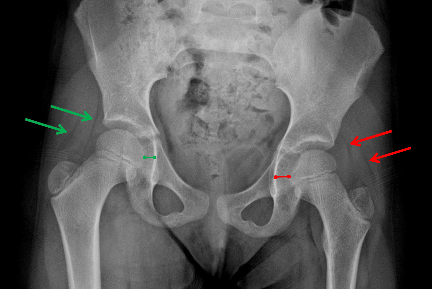 Radiology Case 13 CaseStacks Radiology Case 13 CaseStacks