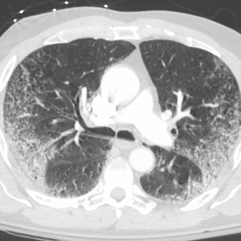 Radiology Case #16 | CaseStacks
