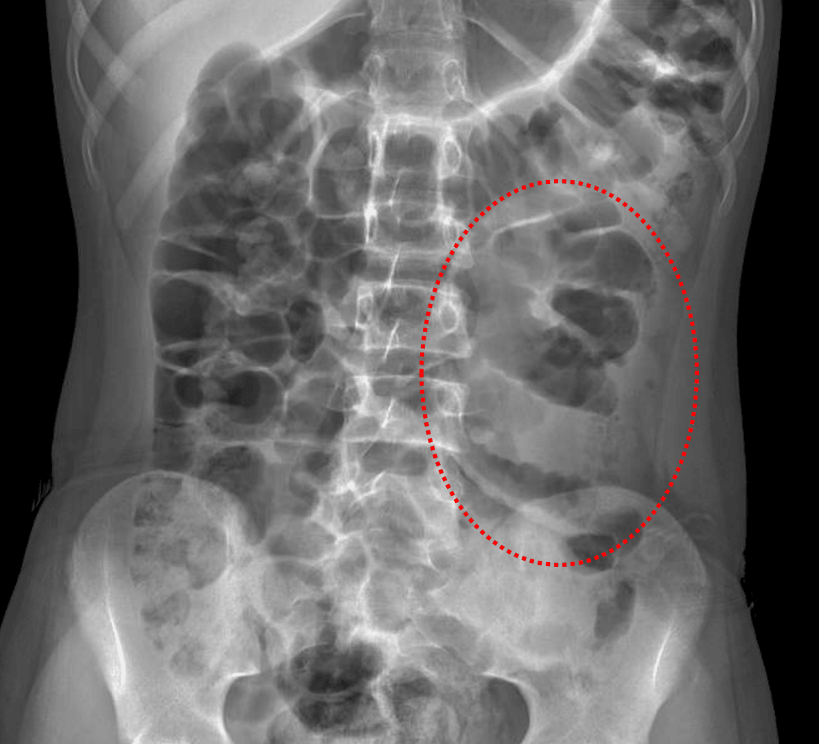 Radiology Case #14 | CaseStacks