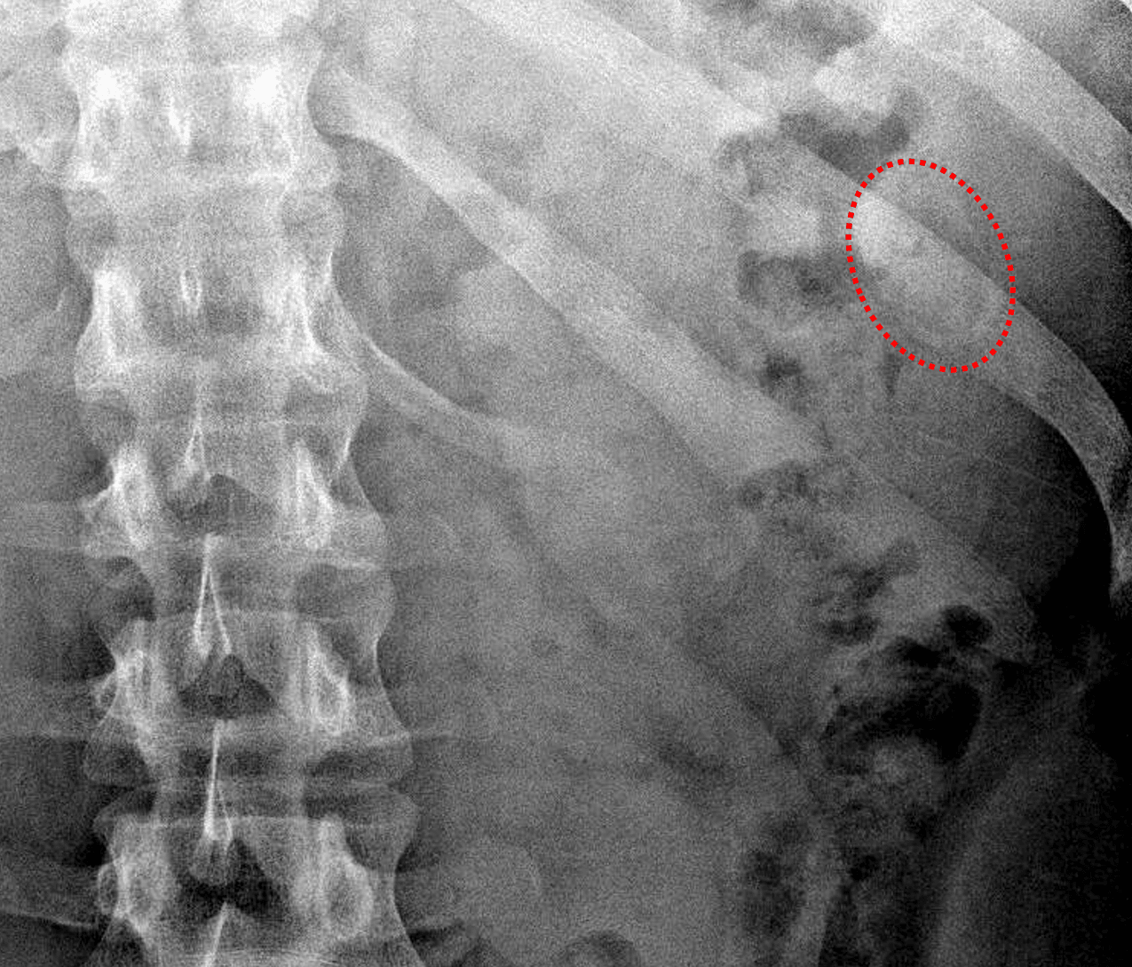 Radiology Case #18 | CaseStacks