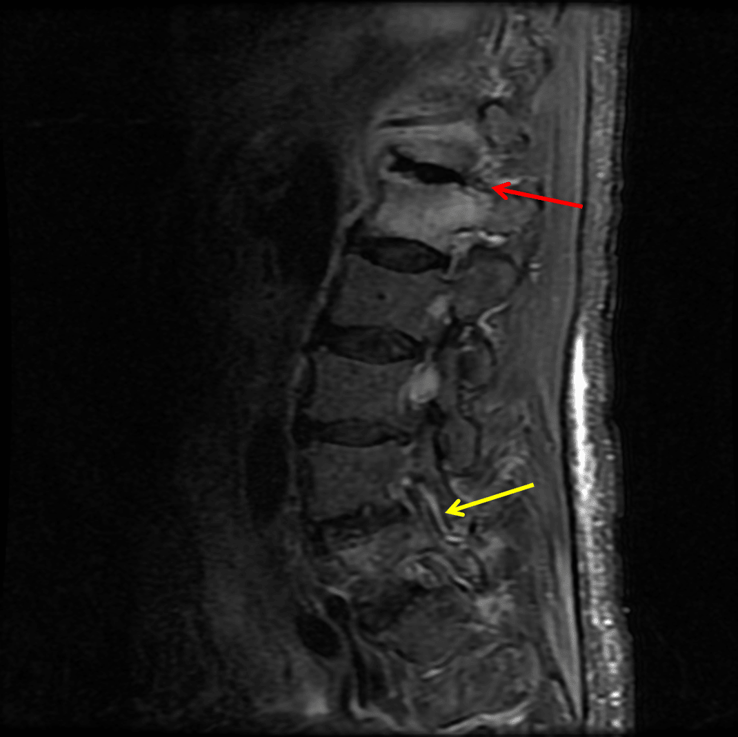 Radiology Case #6 | CaseStacks