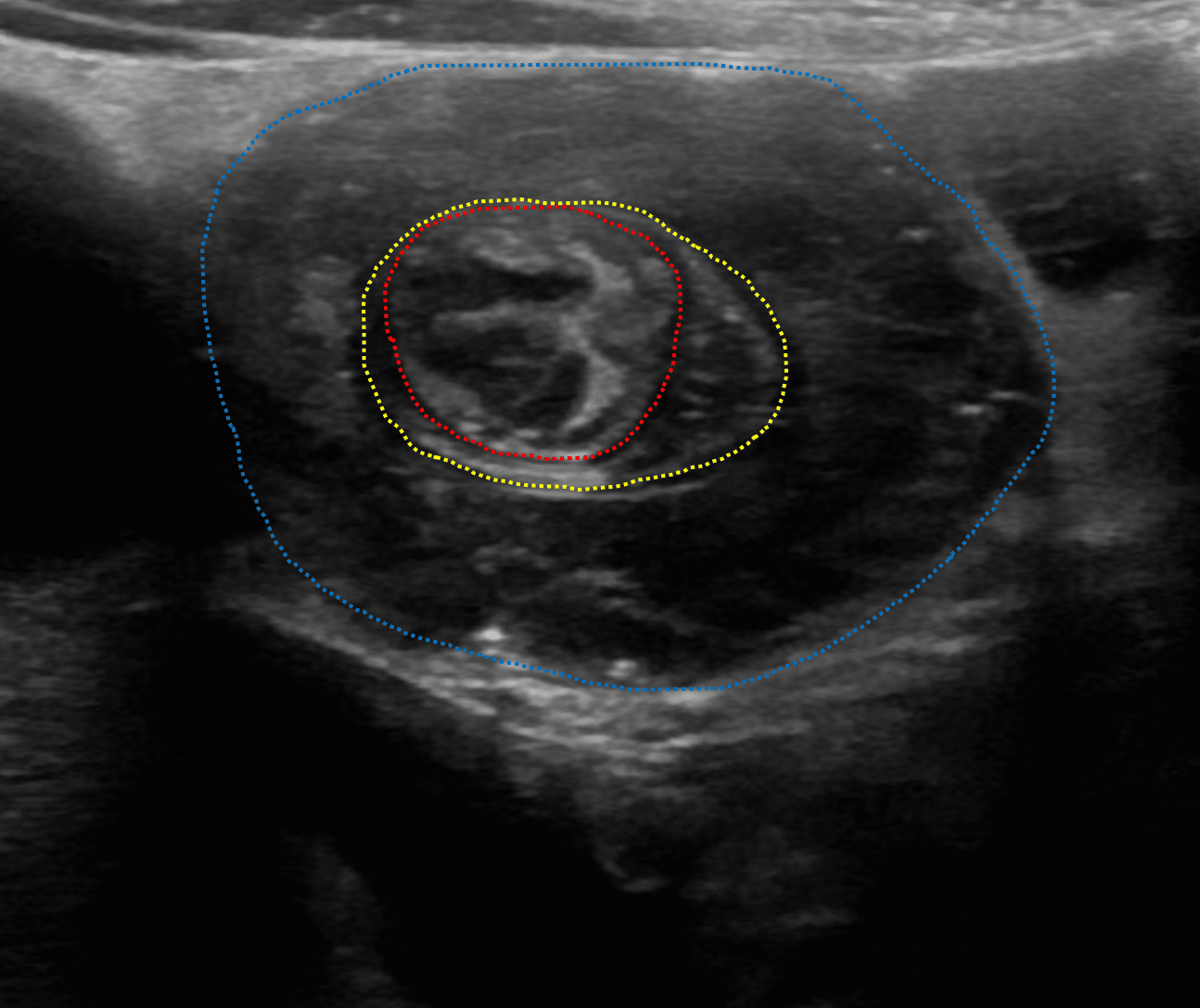 Radiology Case #11 | CaseStacks