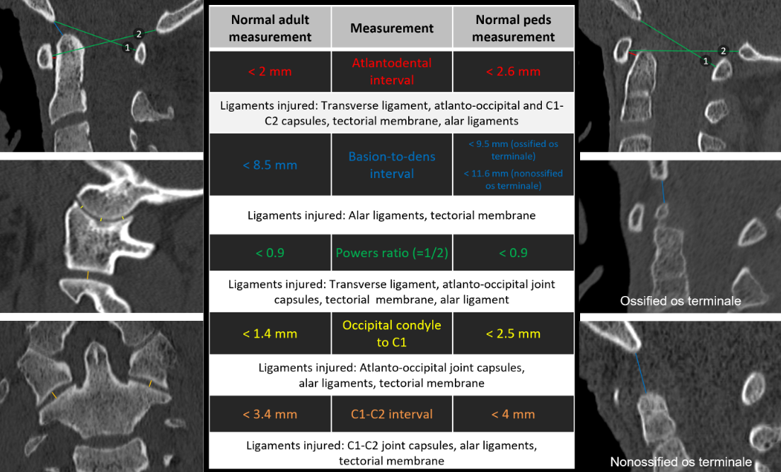 Diagram of helpful measurements to know.