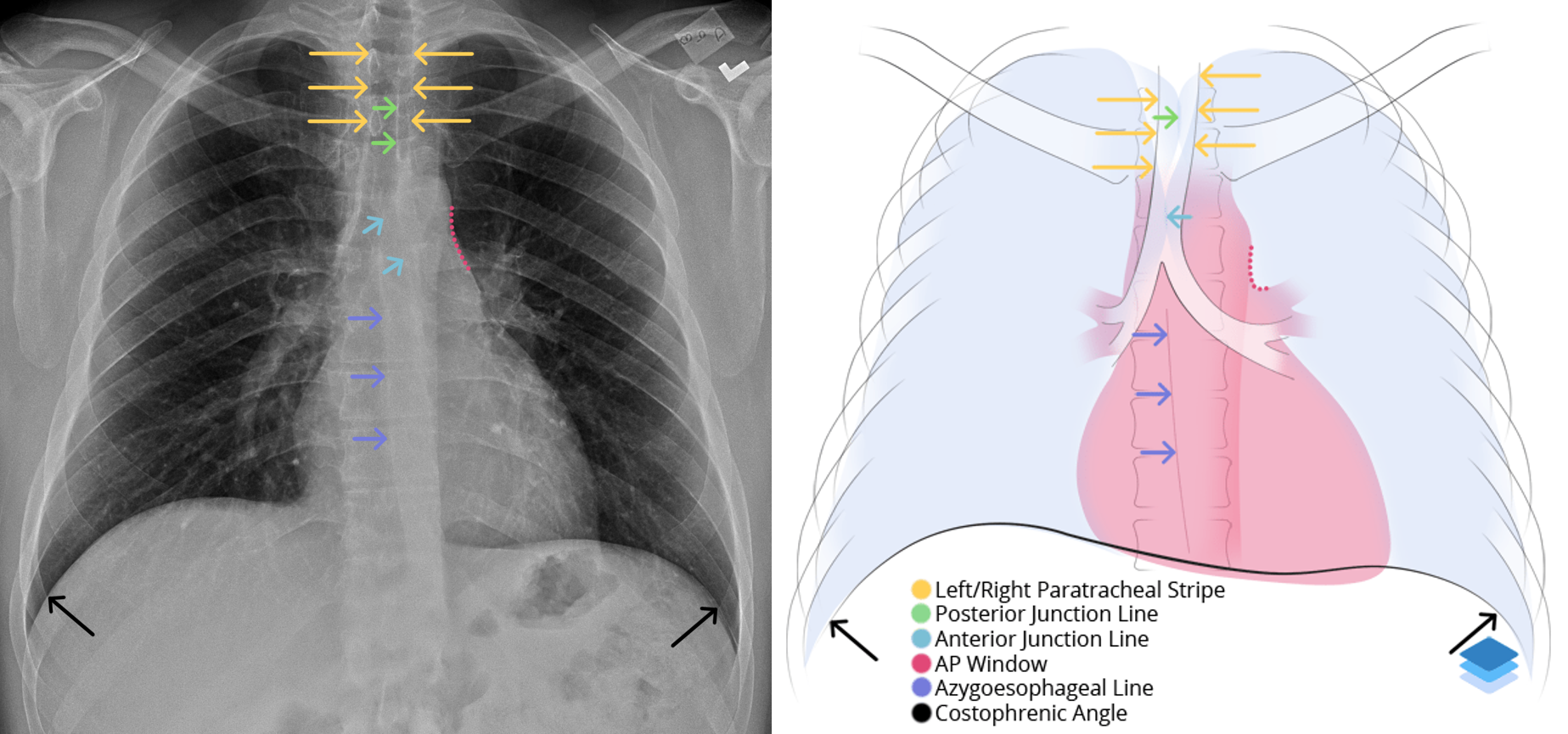 PA Lines and Interfaces