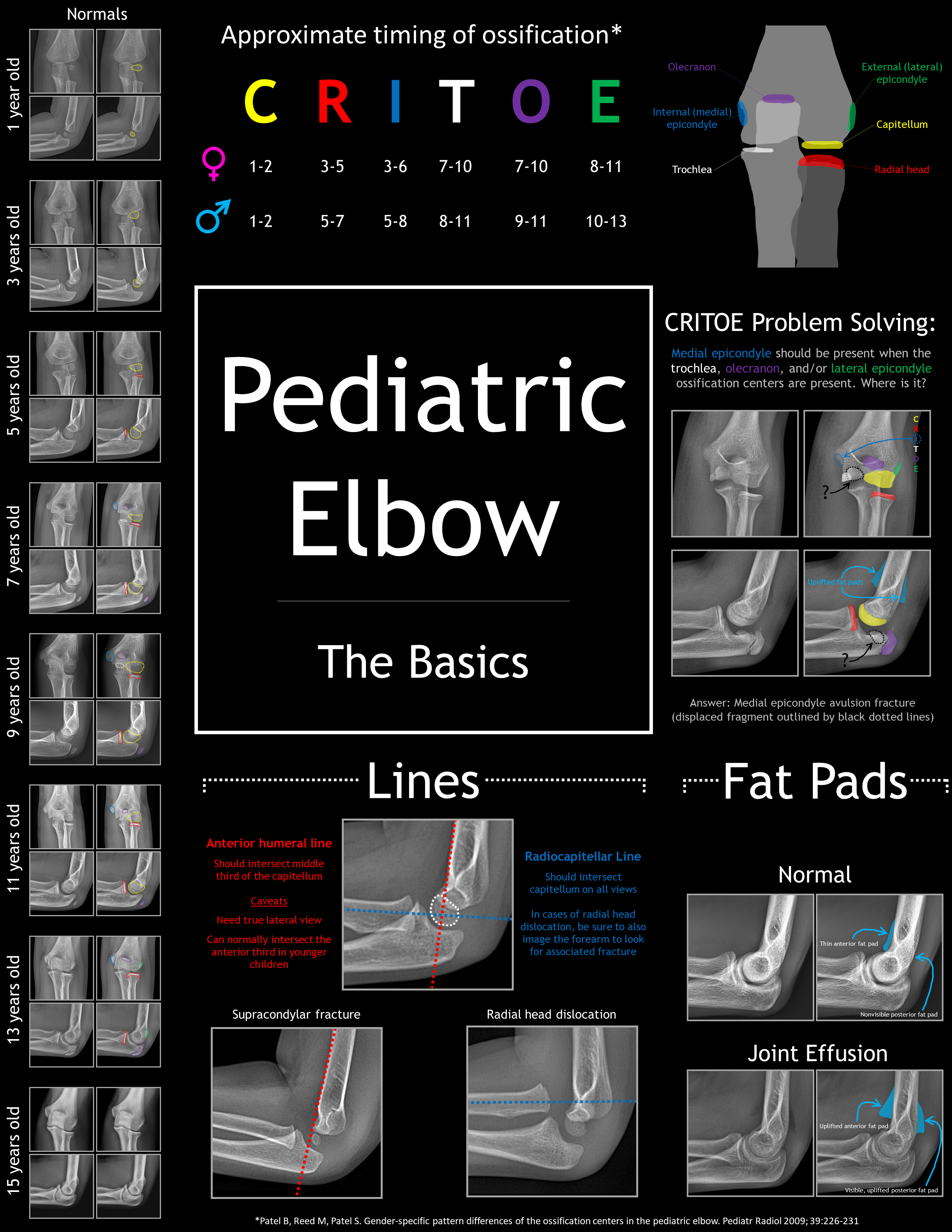 Elbow X-ray Interpretation