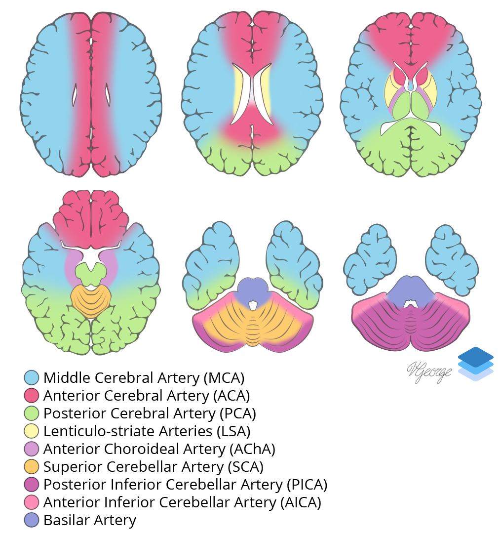 Arterial Vascular Territories