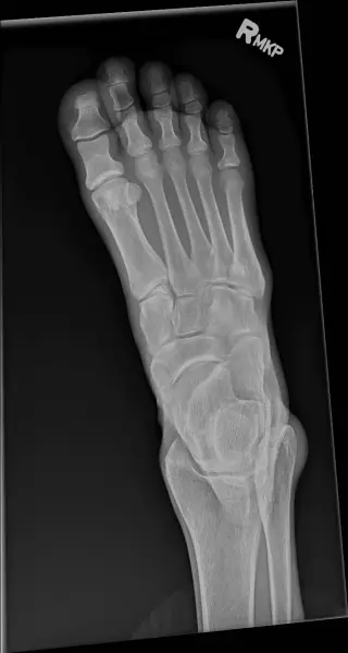 Case #29