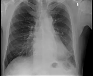 Case #5
