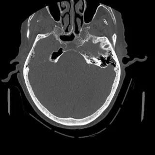 症例 #12