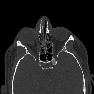 Case #6