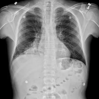 Case #8
