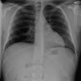 Case #9