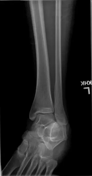 Case #5