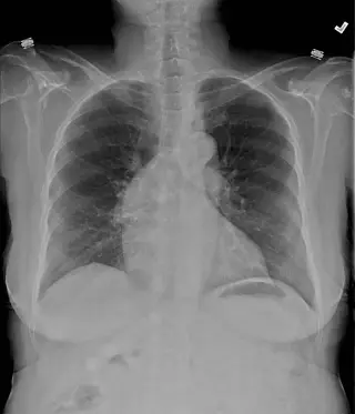 Cas n°9