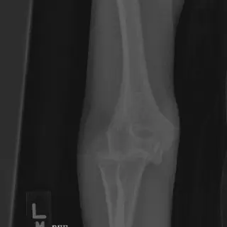 Cas n°6