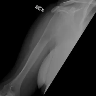 Case #18
