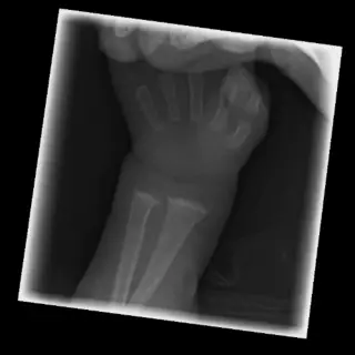 Case #22