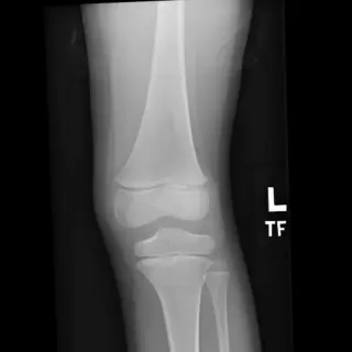 Case #4