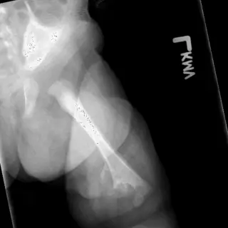 Case #4