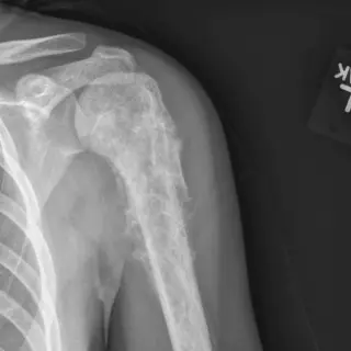 Case #5