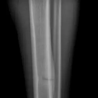 Case #6