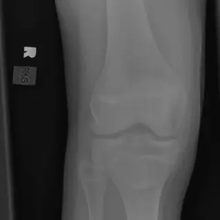 Case #8