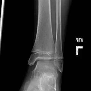 Case #9