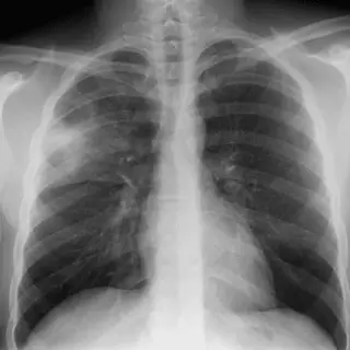 Case #6