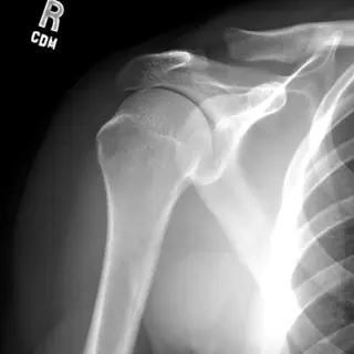 Case #4