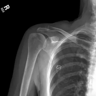 Case #5