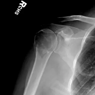 Case #6