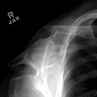 Case #8