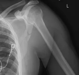 Case #7