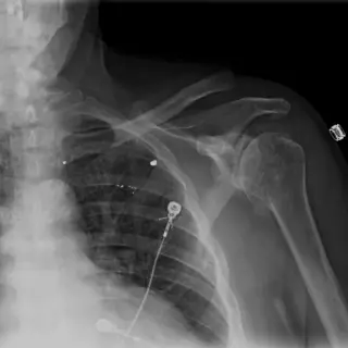 Case #1