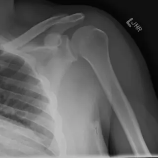 Case #11