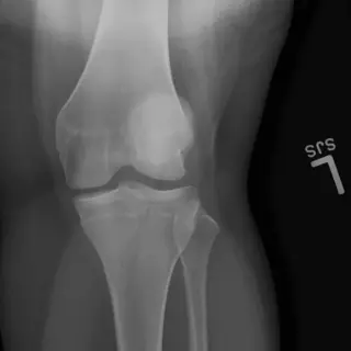 Case #11