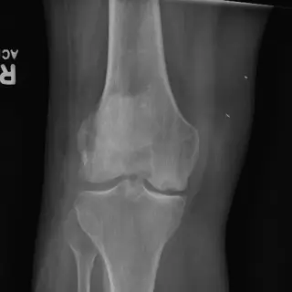 증례 #12