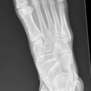 Case #16