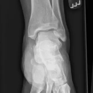 Case #7