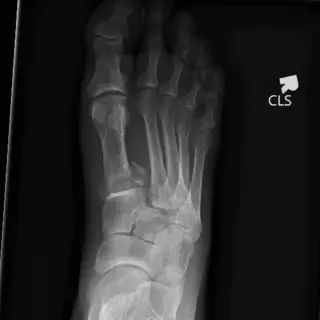 Case #18