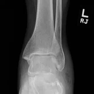 Case #2