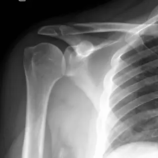 Case #2