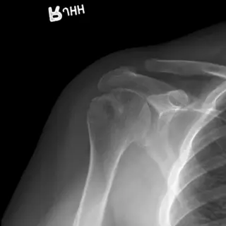 Case #23