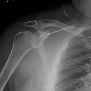 Case #28