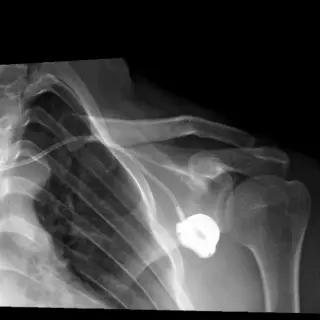 Case #3