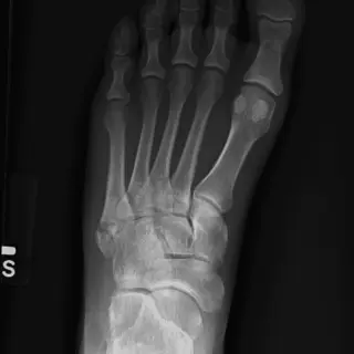 Case #4
