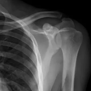 Case #4