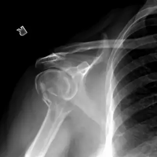 Case #5